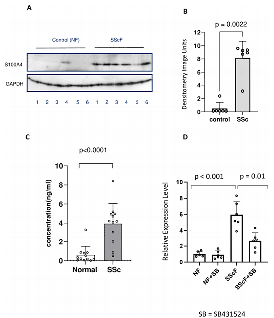 S100A4在系統(tǒng)性硬化癥(SSc)成纖維細(xì)胞中的表達(dá)和釋放