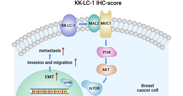 CT83/KK-LC-1通過MAL2/MUC1-C/PI3K/AKT/mTOR途徑調(diào)節(jié)TNBC