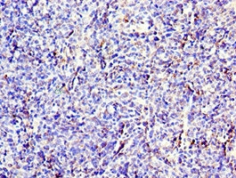 CSB-PA326953ESR1HU IHC-2