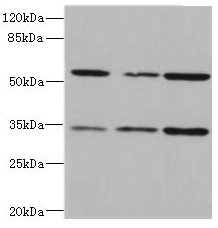 CSB-PA882088ESR1HU