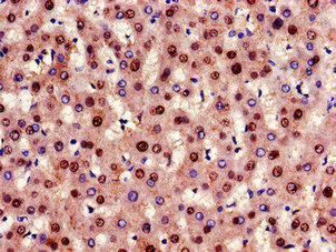 CSB-PA009316LA01HU IHC