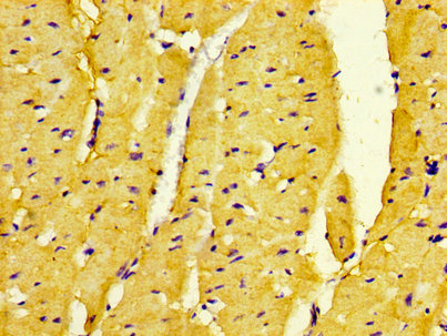 CSB-PA006968LA01HU IHC-2