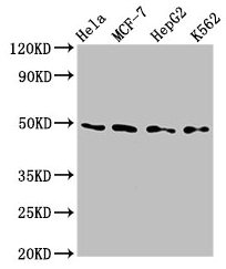 CSB-PA618010LA01HU