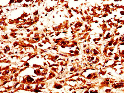 CSB-PA021324LA01HU IHC-2