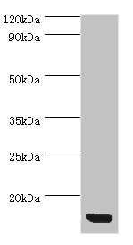 CSB-PA004775ESR2HU