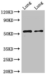 CSB-PA010890LA01HU