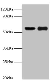 CSB-PA017306ESR2HU