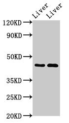 CSB-PA021061LA01HU