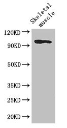 CSB-PA021760LA01HU