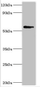 CSB-PA888000ESR2HU