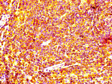 CSB-RA002611A0HU IHC