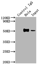 CSB-RA246102A0HU