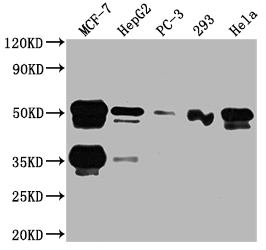 CSB-RA246102A0HU