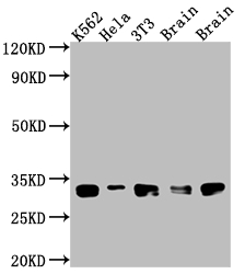 CSB-RA247982A0HU