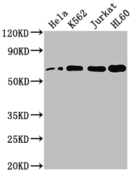 CSB-RA299884A0HU