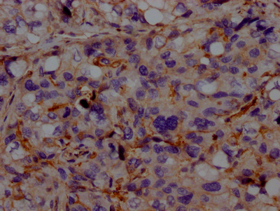 CSB-BP001262HU1 IHC