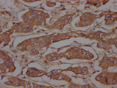 CSB-RA634199A0HU IHC