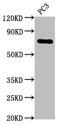 CSB-RA887971A0HU