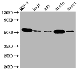 CSB-RA917625A0HU