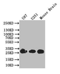 CSB-RA989910A0HU