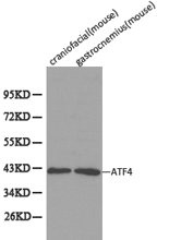 CSB-PA002272KA01HU