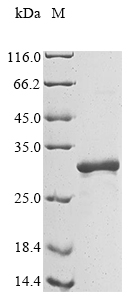 CSB-EP002655HU(A4)