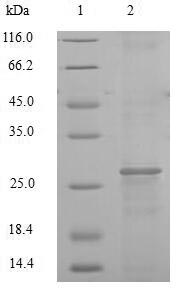 CSB-EP006192HU