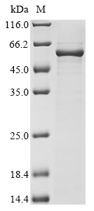 CSB-EP006766HU