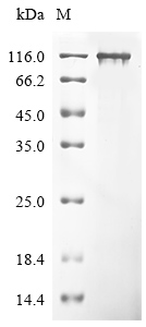 CSB-EP871382HUa0