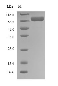 CSB-MP007723HU SDS-PAGE