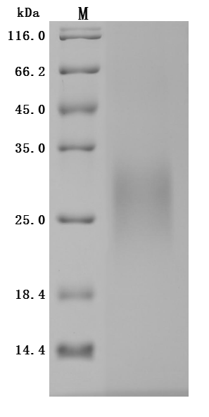 CSB-MP862025HU-SDS