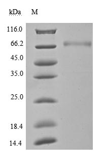 CSB-MP878942HU1 SDS-PAGE