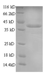 CSB-EP005386TOTa2-SDS