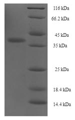 CSB-EP011865HU