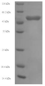 CSB-EP017306HU