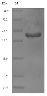 CSB-EP025781HU