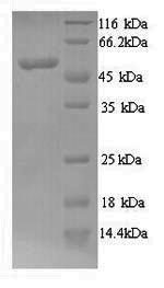 CSB-YP015278HU DS-PAGE