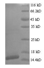 CSB-YP361948HMN DS-PAGE