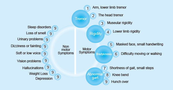 帕金森病的癥狀