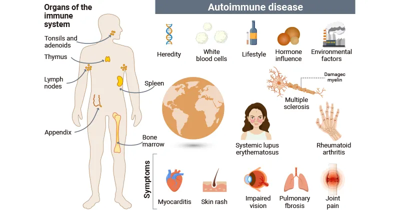 自身免疫性疾病的誘因和常見癥狀