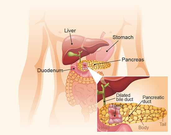 胰腺結(jié)構(gòu)示意圖